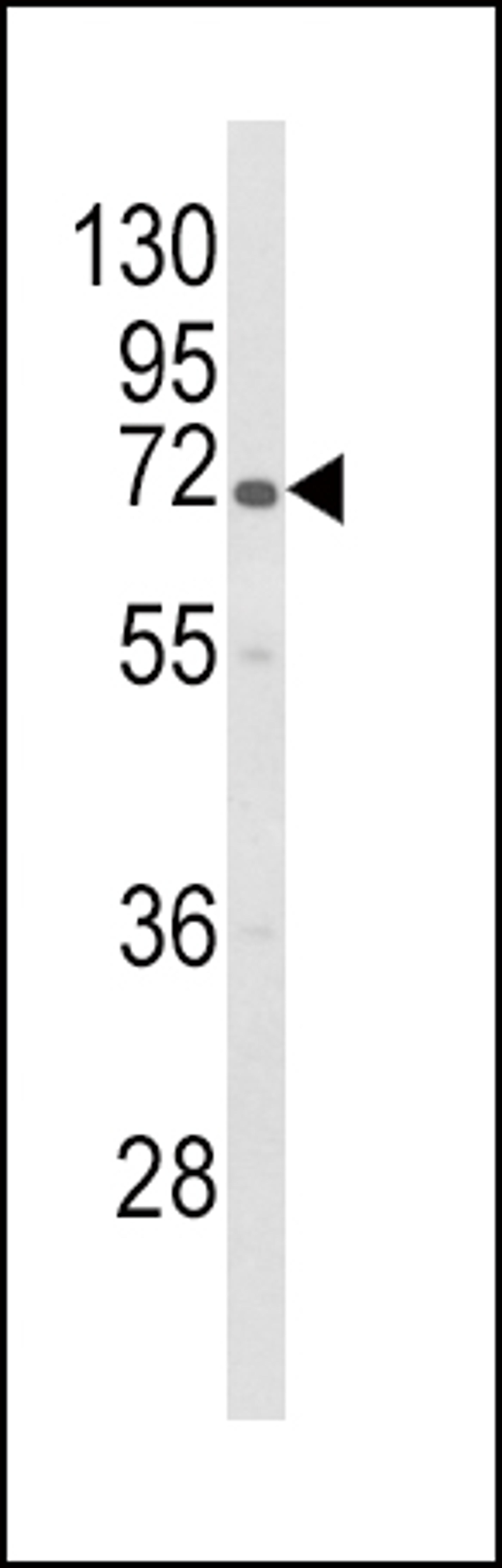 Western blot analysis of GBE1 Antibody in HL-60 cell line lysates (35ug/lane).