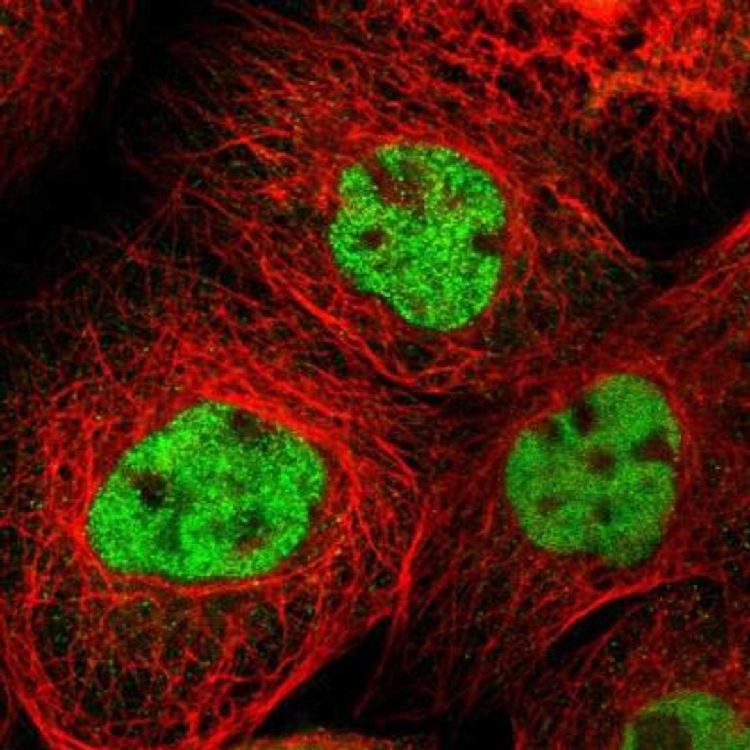 Immunocytochemistry/Immunofluorescence: MYOM1 Antibody [NBP1-86460] - Immunofluorescent staining of human cell line A-431 shows positivity in nuclei but not nucleoli.