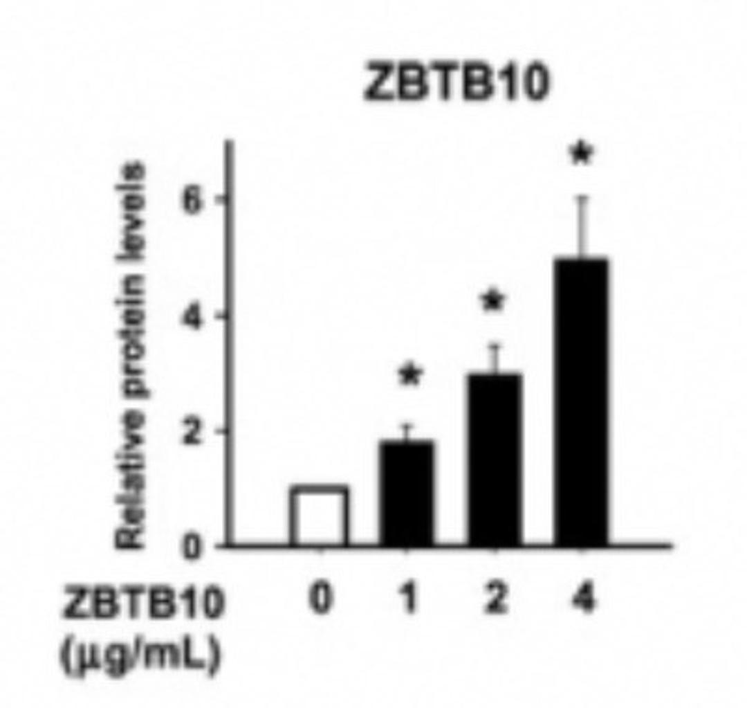 ELISA: ZBTB46 Antibody [NBP2-27211] - ELISA analysis of ZBTB10 expression. MDA-MB-231 cells were transiently transfected with 0-4 ug of a ZBTB10 expression plasmid and analyzed for ZBTB10 expression after 24 h. Columns, means for 3 replicate ELISAs. Bars, SE. *, P < 0.05.