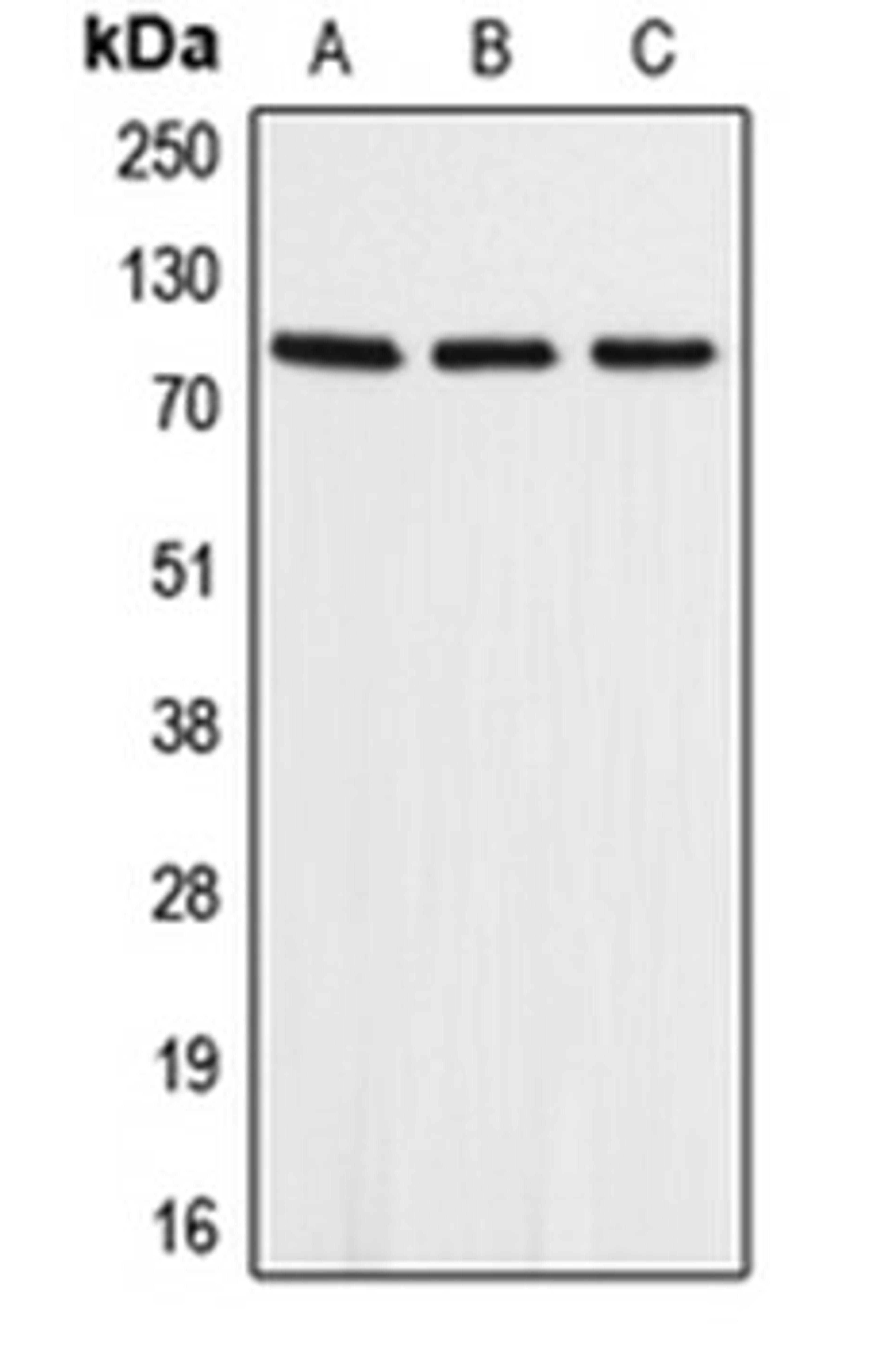 Western blot analysis of A549 (Lane 1), mouse heart (Lane 2), rat heart (Lane 3) whole cell lysates using APLP2 antibody