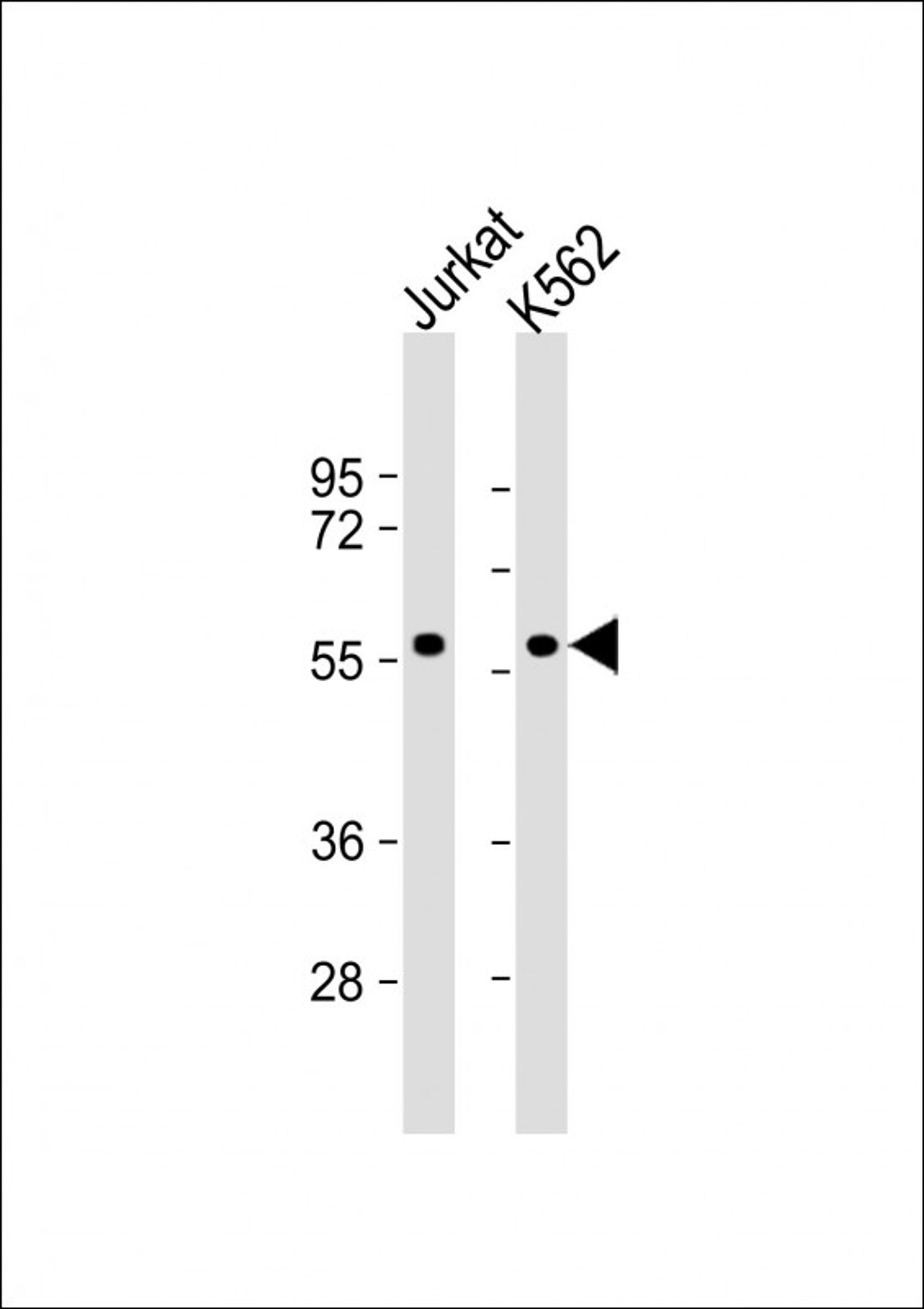 Western Blot at 1:1000 dilution Lane 1: Jurkat whole cell lysate Lane 2: K562 whole cell lysate Lysates/proteins at 20 ug per lane.