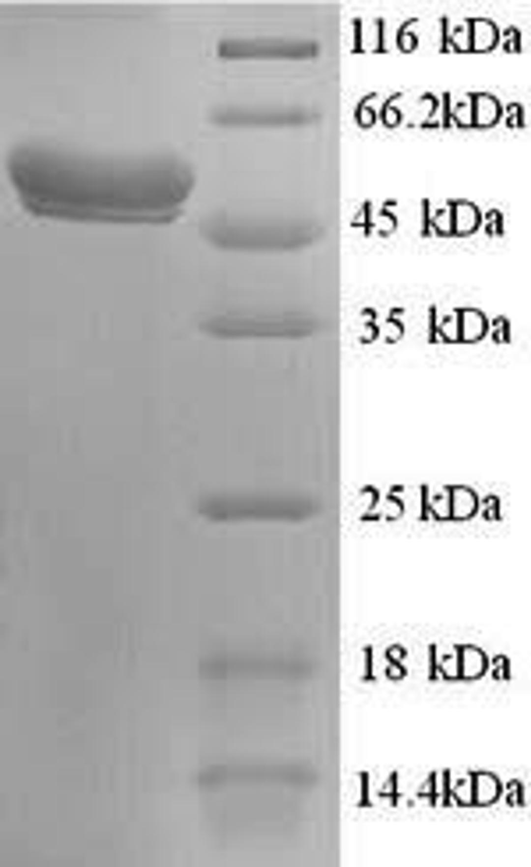 (Tris-Glycine gel) Discontinuous SDS-PAGE (reduced) with 5% enrichment gel and 15% separation gel.