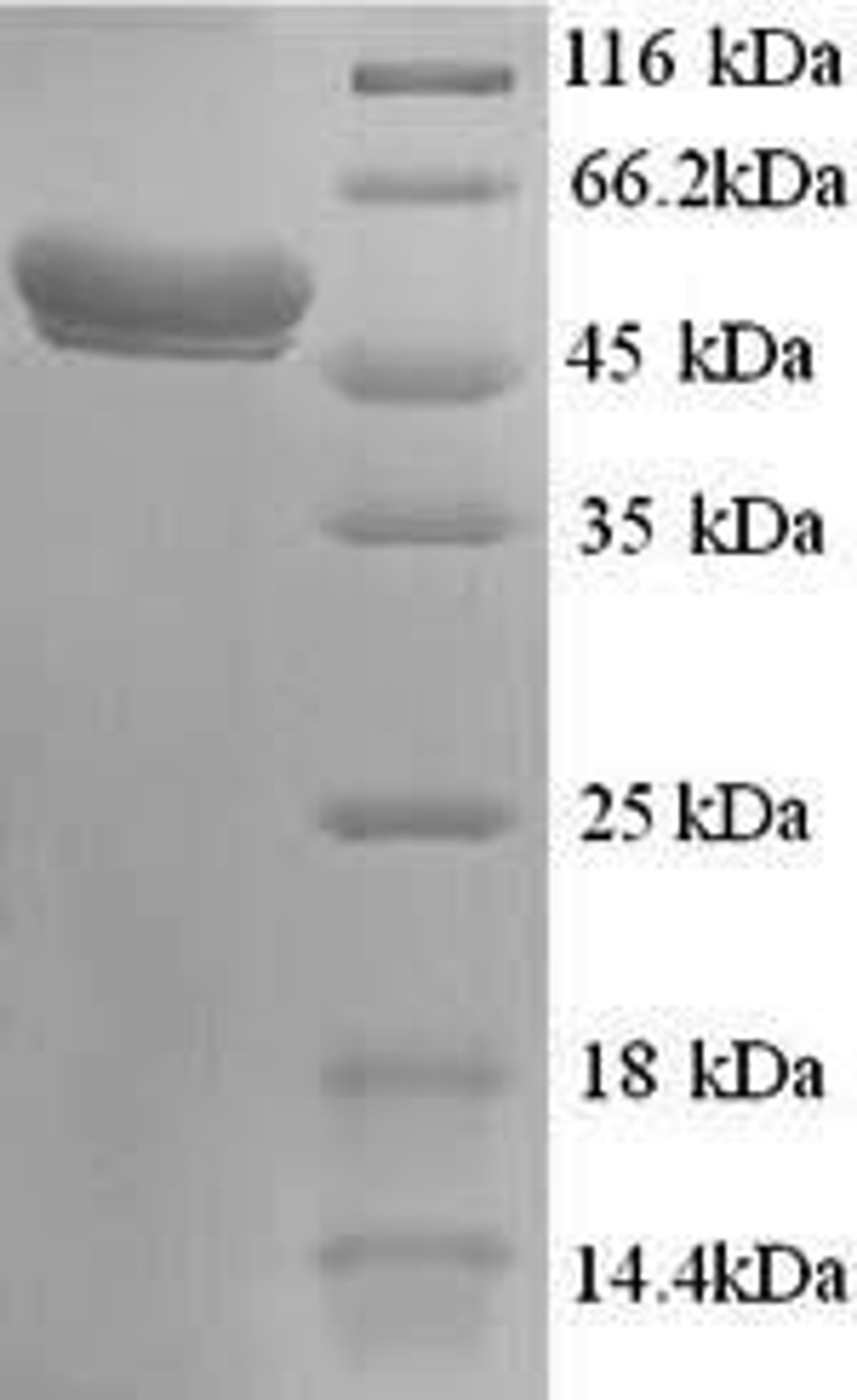 (Tris-Glycine gel) Discontinuous SDS-PAGE (reduced) with 5% enrichment gel and 15% separation gel.