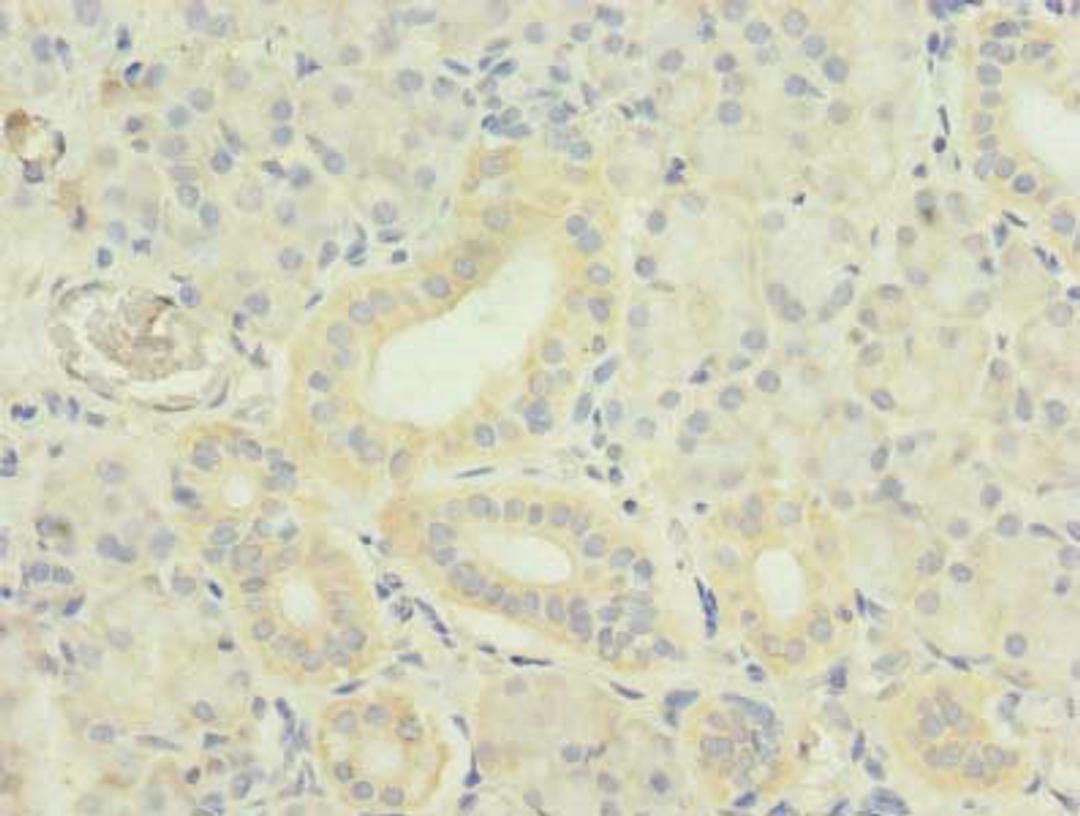 Immunohistochemistry of paraffin-embedded human pancreatic tissue using CSB-PA023987LA01HU at dilution of 1:100