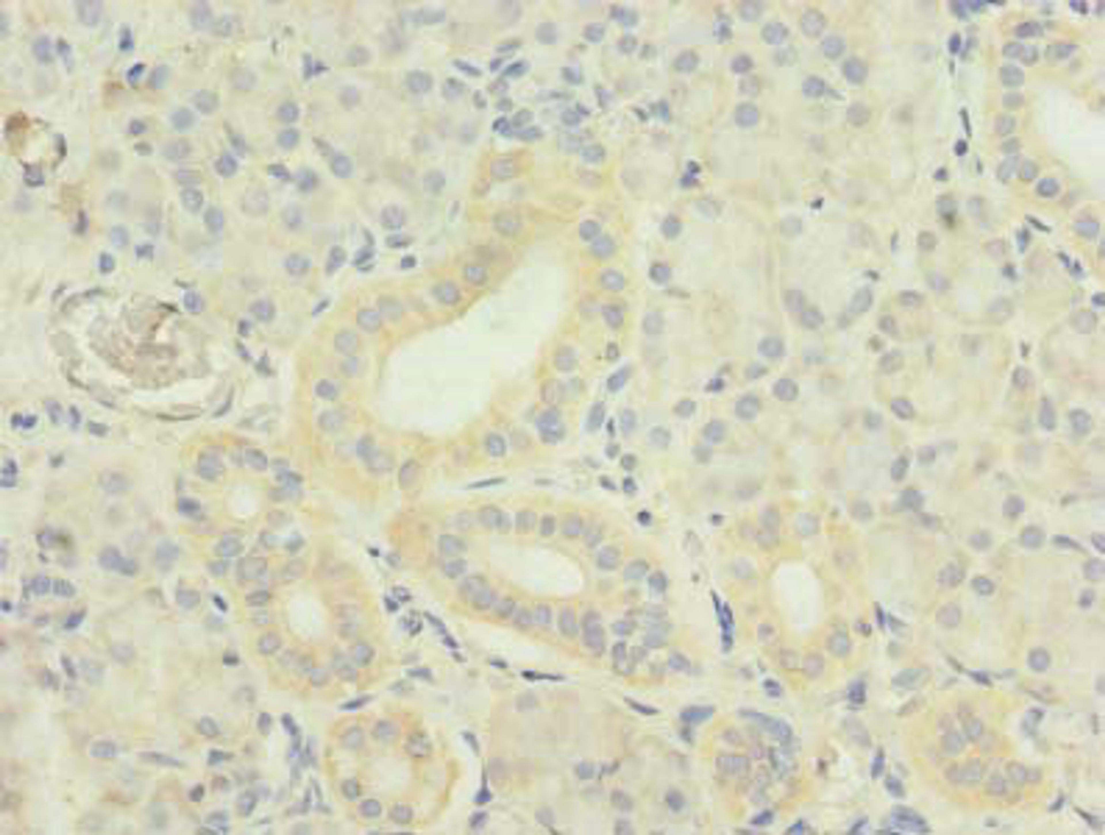 Immunohistochemistry of paraffin-embedded human pancreatic tissue using CSB-PA023987LA01HU at dilution of 1:100