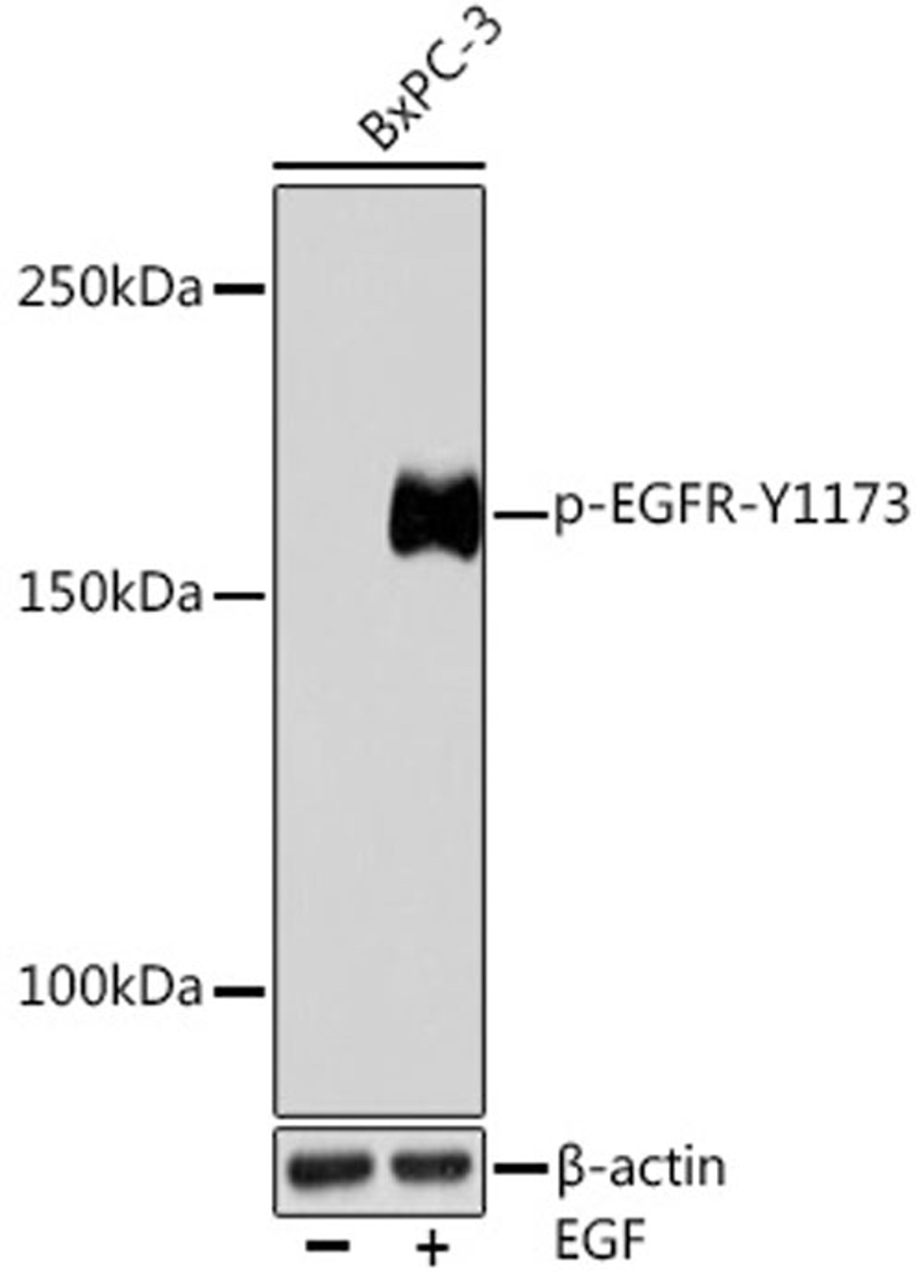 Western blot - Phospho-EGFR-Y1173 Rabbit mAb (AP0992)