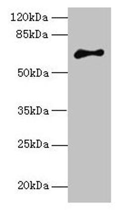Western blot. All lanes: ARMCX2 antibody at 5µg/ml + MCF-7 whole cell lysate. Secondary. Goat polyclonal to rabbit IgG at 1/10000 dilution. Predicted band size: 66 kDa. Observed band size: 66 kDa
