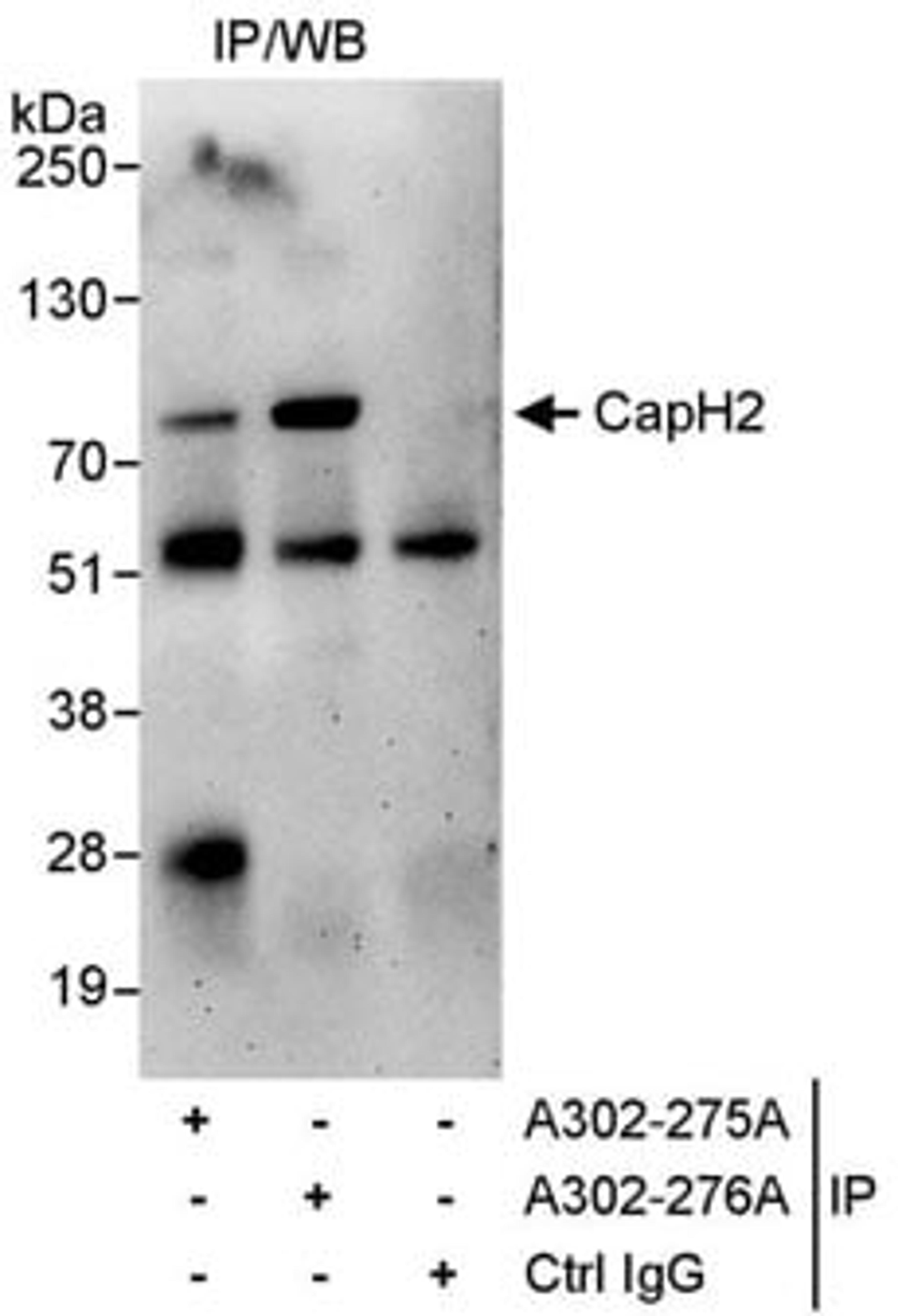 Detection of human CapH2 by western blot of immunoprecipitates.