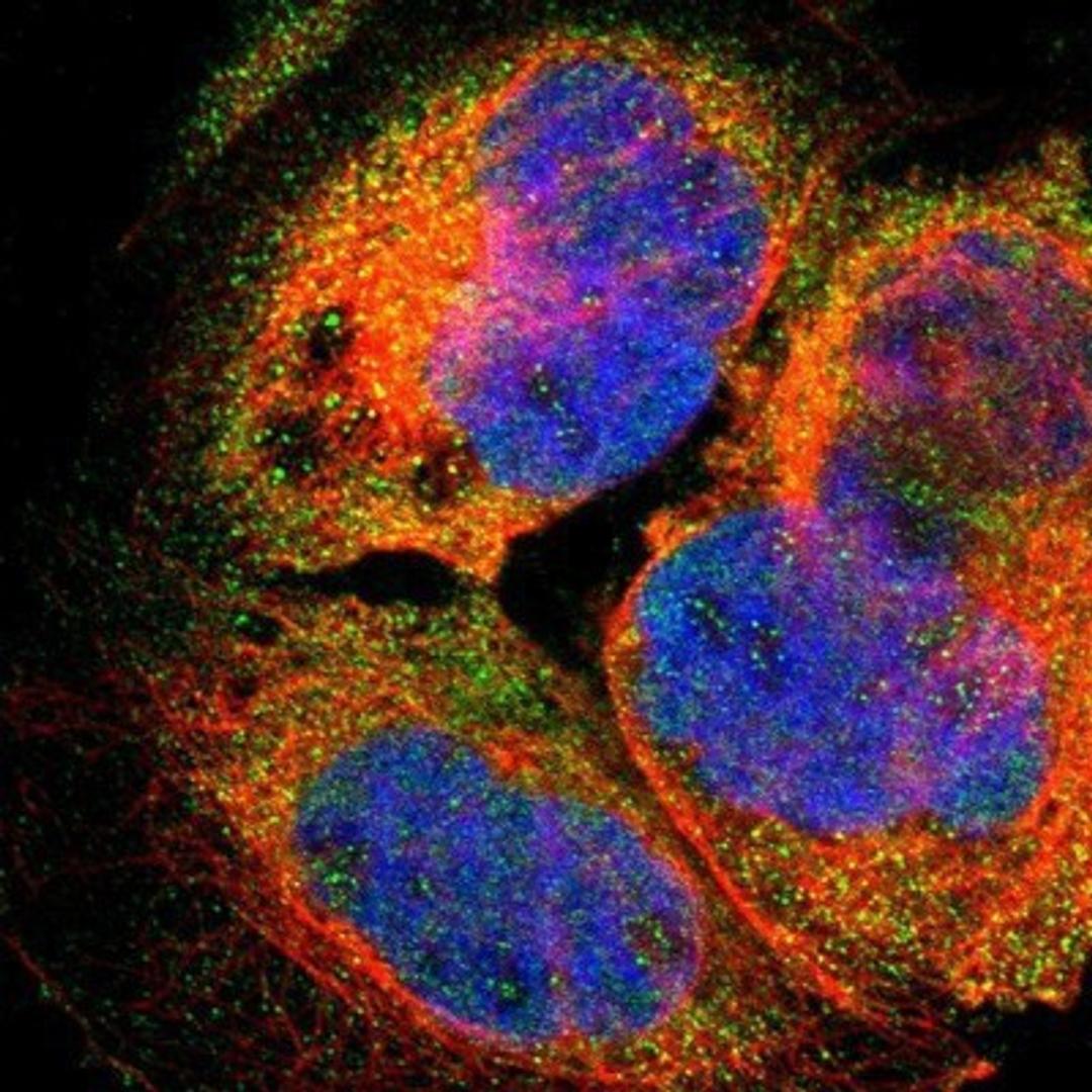 Immunocytochemistry/Immunofluorescence: C8orf40 Antibody [NBP1-89554] - Staining of human cell line A-431 shows positivity in nucleoli & cytoplasm.