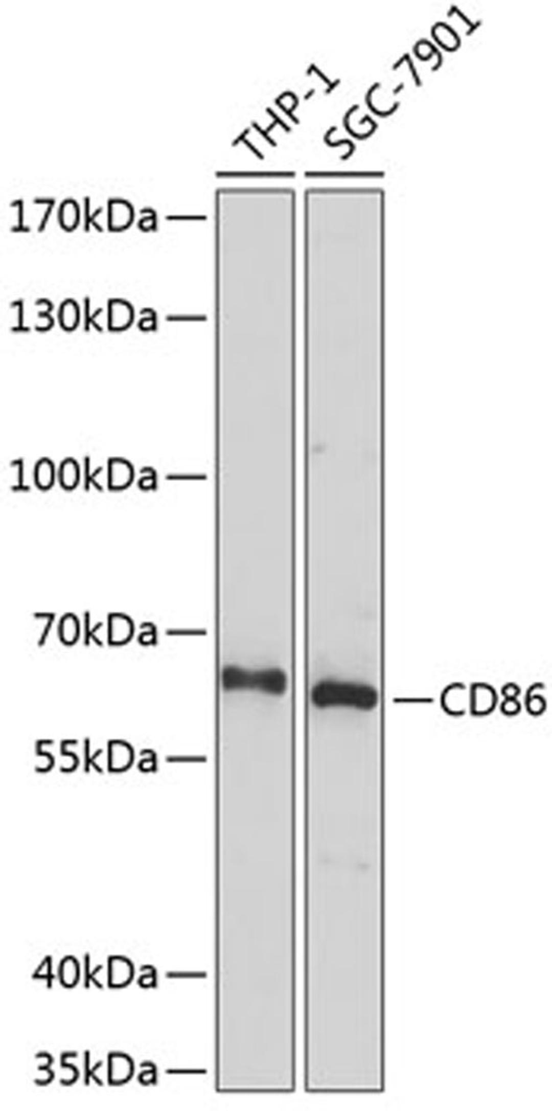 Western blot - CD86 Antibody (A2353)