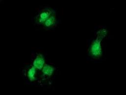 Immunocytochemistry/Immunofluorescence: GCKR Antibody (1E7) [NBP2-03396] Staining of COS7 cells transiently transfected by pCMV6-ENTRY GCKR.