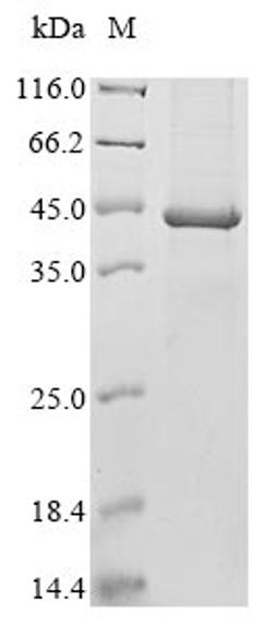 (Tris-Glycine gel) Discontinuous SDS-PAGE (reduced) with 5% enrichment gel and 15% separation gel.