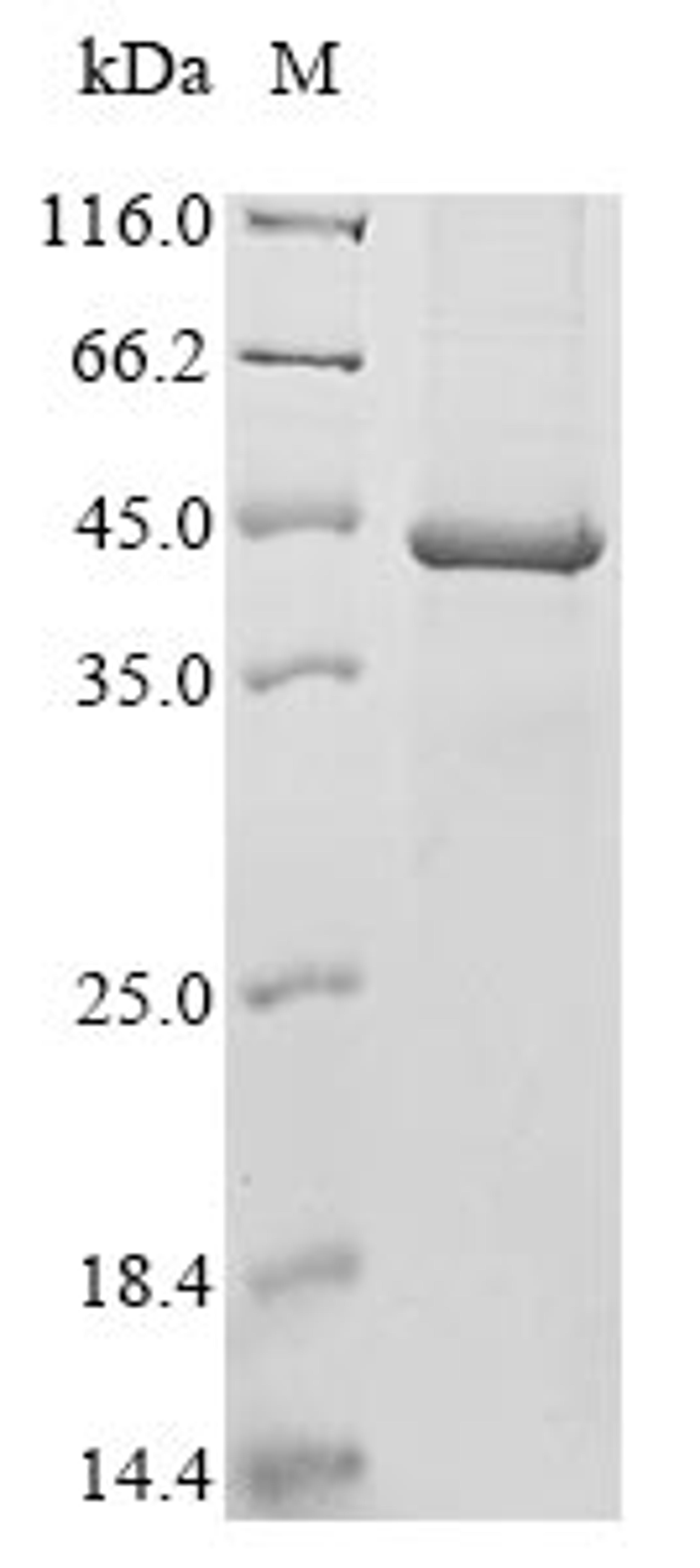 (Tris-Glycine gel) Discontinuous SDS-PAGE (reduced) with 5% enrichment gel and 15% separation gel.