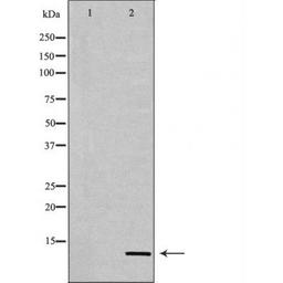 Western blot analysis of various cell lines using Histone H4K20me3 antibody