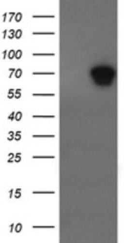 Immunohistochemistry: ALX4 Antibody (6B3) [NBP2-45490] - Analysis of HEK293T cells were transfected with the pCMV6-ENTRY control (Left lane) or pCMV6-ENTRY ALX4.