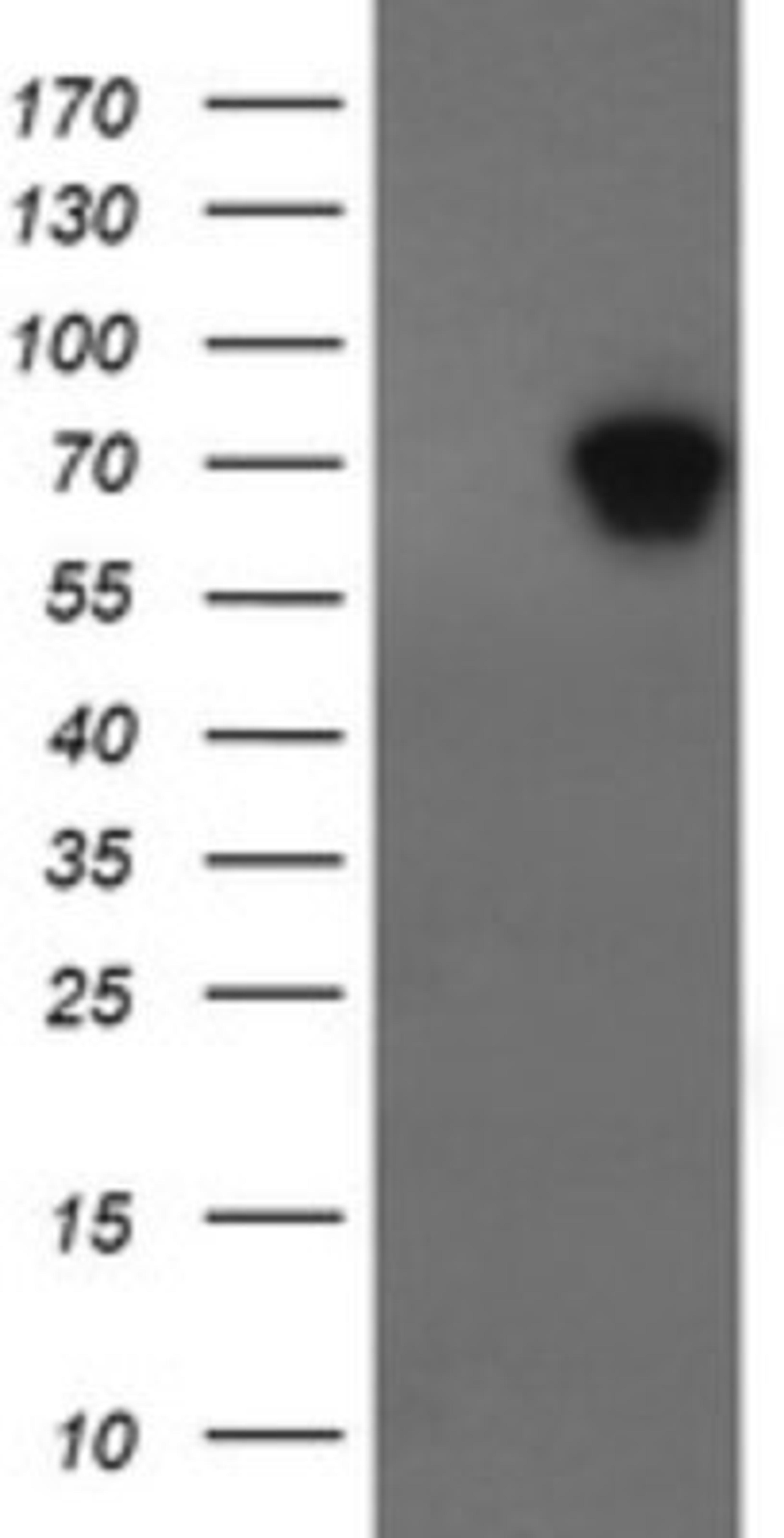 Immunohistochemistry: ALX4 Antibody (6B3) [NBP2-45490] - Analysis of HEK293T cells were transfected with the pCMV6-ENTRY control (Left lane) or pCMV6-ENTRY ALX4.