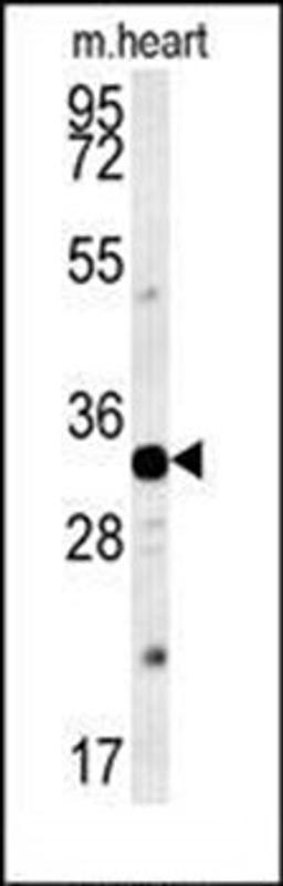 Western blot analysis of mouse heart tissue lysates (15ug/lane) using AQP11 antibody