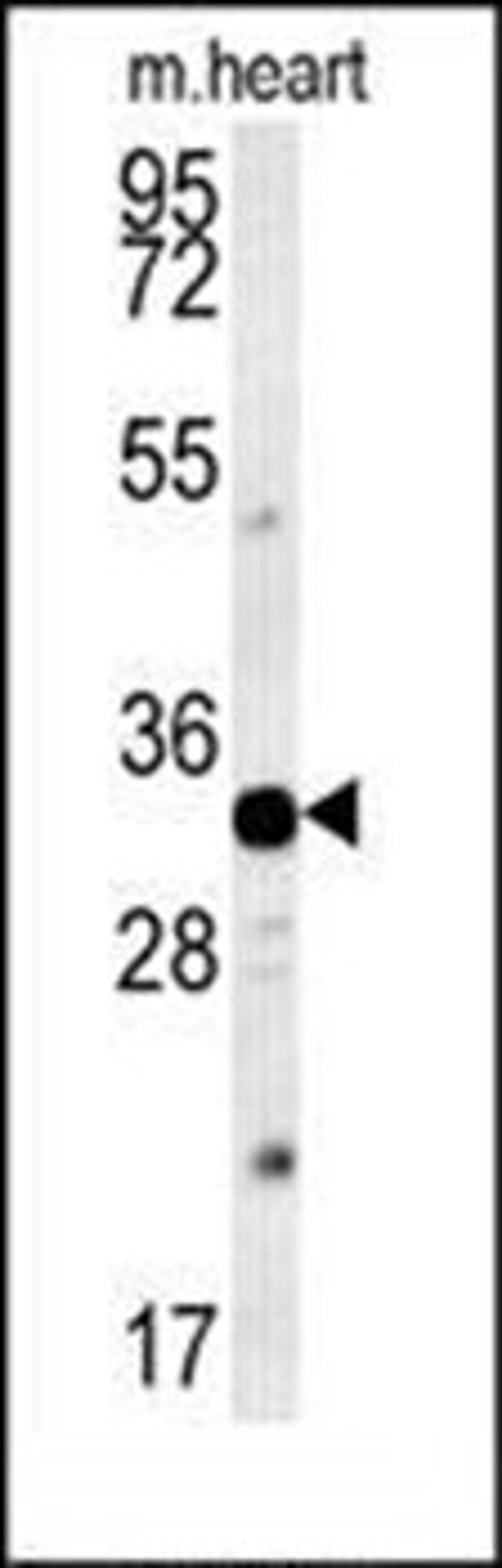 Western blot analysis of mouse heart tissue lysates (15ug/lane) using AQP11 antibody