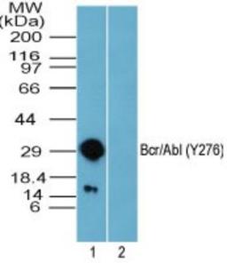 Western Blot: Bcr [p Tyr276] Antibody [NBP2-24460] - Analysis of phospho Bcr (Y276) in recombinant fusion protein containing 1) a phosphorylated tyrosine at position 276 and 2) an unphosphorylated tyrosine at position 276, using Bcr phospho antibody at 0.01 ug/ml. I goat anti-rabbit Ig HRP secondary antibody and PicoTect ECL substrate solution were used for this test.