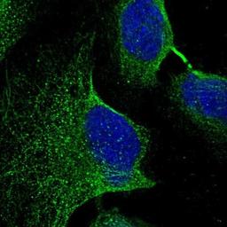 Immunocytochemistry/Immunofluorescence: C9orf128 Antibody [NBP1-90932] - Staining of human cell line U-2 OS shows positivity in cytoskeleton (microtubules).