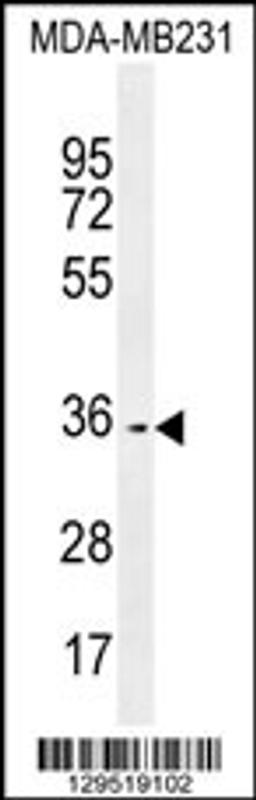 Western blot analysis in MDA-MB231 cell line lysates (35ug/lane).