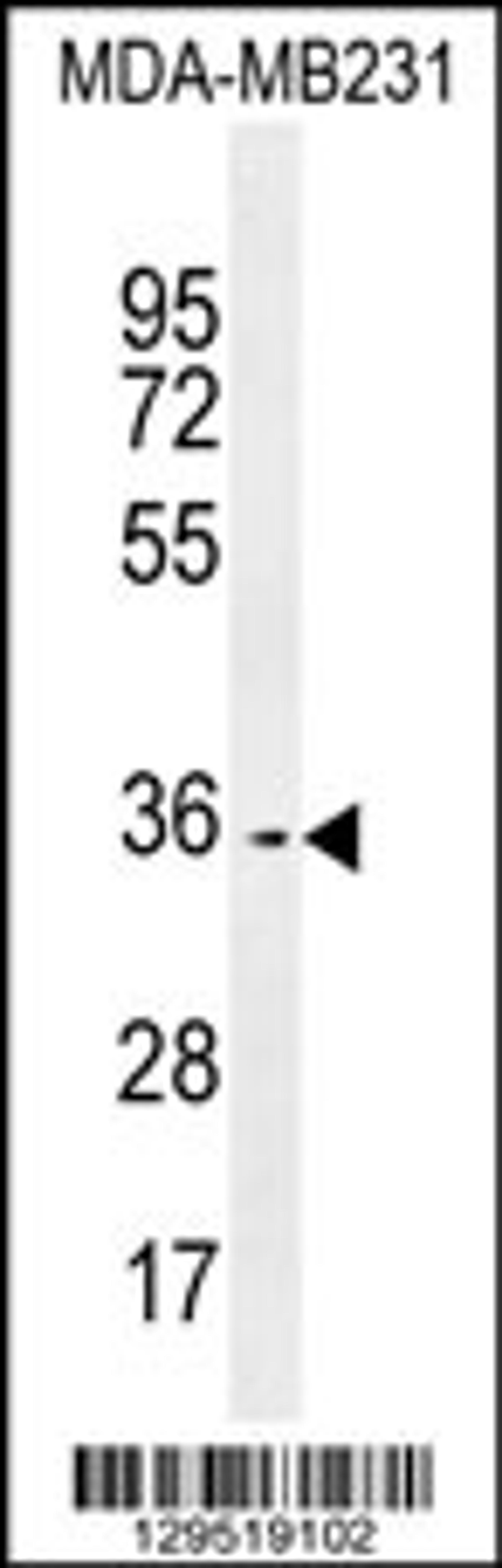 Western blot analysis in MDA-MB231 cell line lysates (35ug/lane).