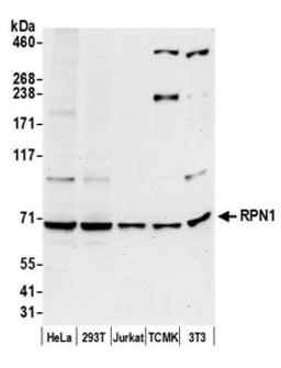 Detection of human and mouse RPN1 by western blot.