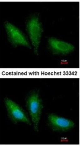 Immunocytochemistry/Immunofluorescence: PRKCSH Antibody [NBP1-32006] - Paraformaldehyde-fixed A549, using antibody at 1:200 dilution.