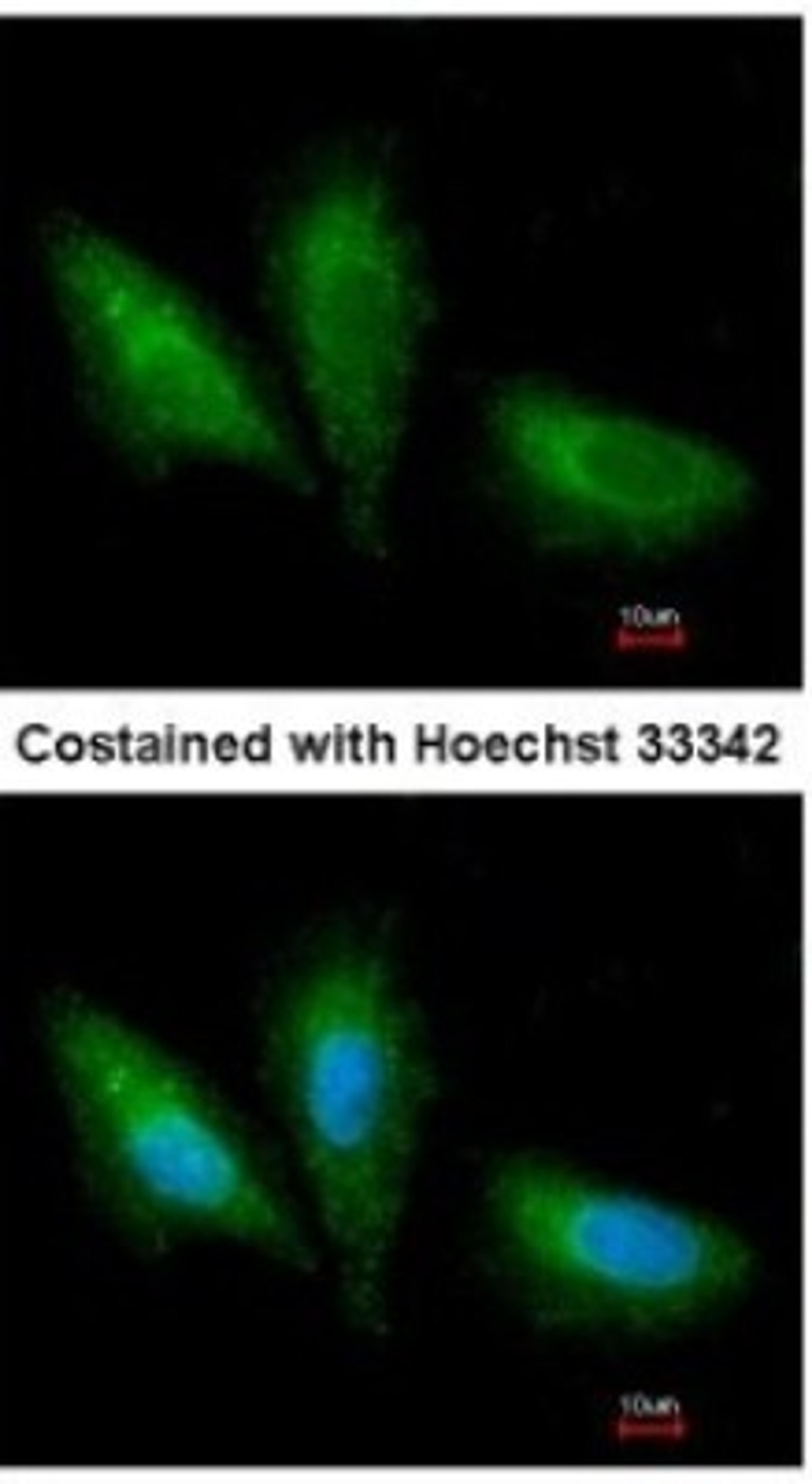 Immunocytochemistry/Immunofluorescence: PRKCSH Antibody [NBP1-32006] - Paraformaldehyde-fixed A549, using antibody at 1:200 dilution.