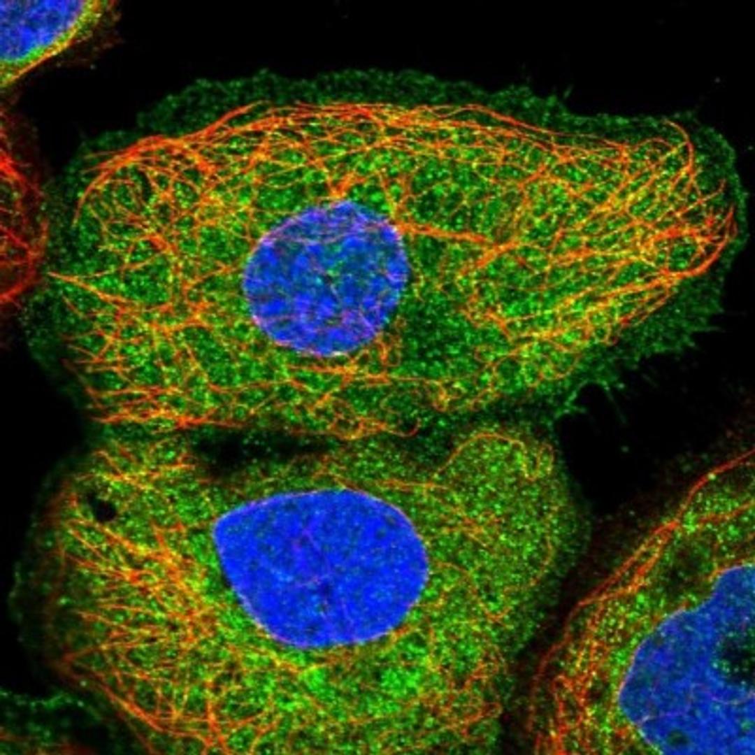 Immunocytochemistry/Immunofluorescence: FLAD1 Antibody [NBP1-84752] - Staining of human cell line A-431 shows positivity in plasma membrane & cytoplasm.