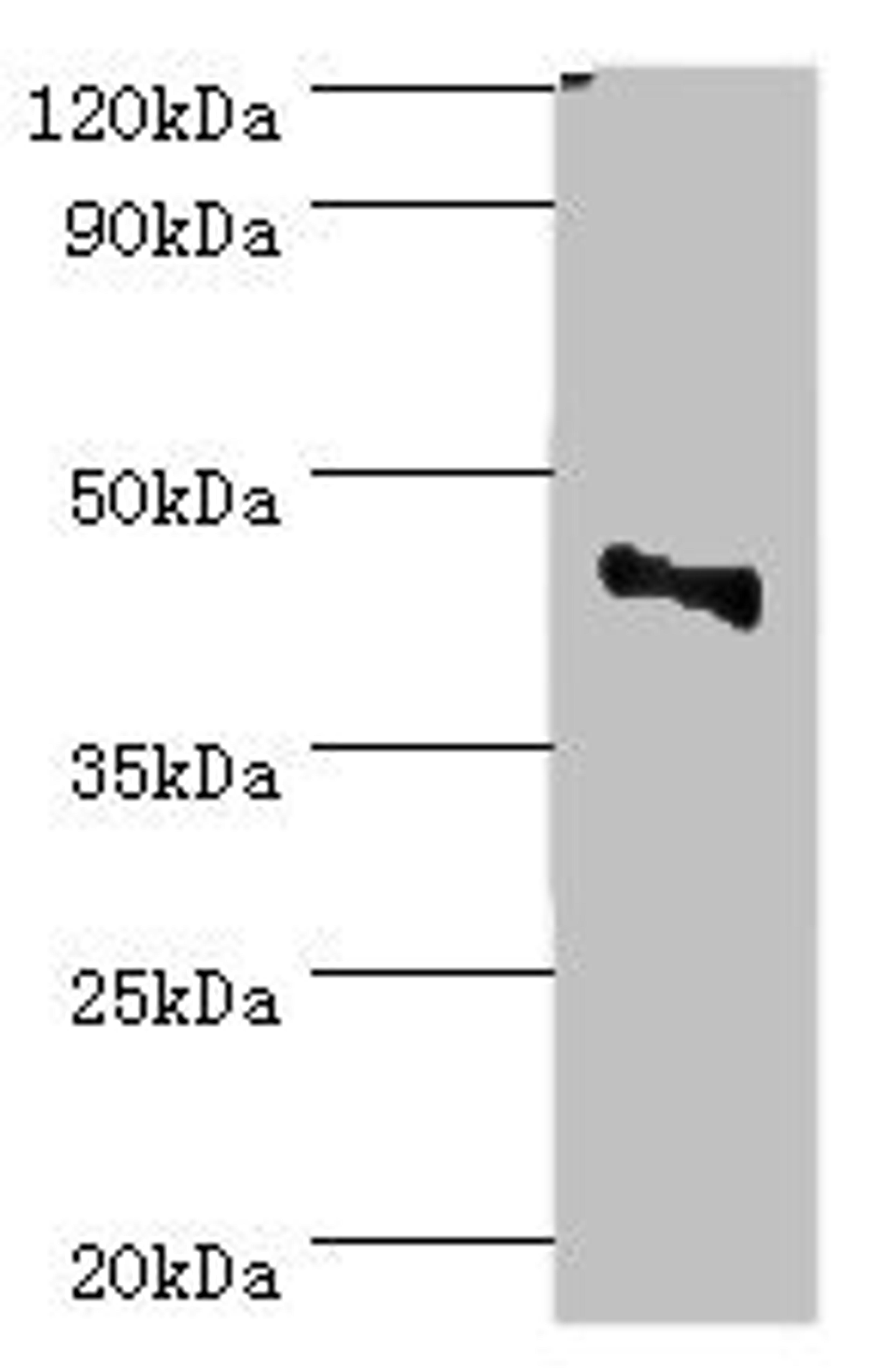 Western blot. All lanes: CBX8 antibody at 2ug/ml + Jurkat whole cell lysate. Secondary. Goat polyclonal to rabbit IgG at 1/10000 dilution. Predicted band size: 43 kDa. Observed band size: 43 kDa.