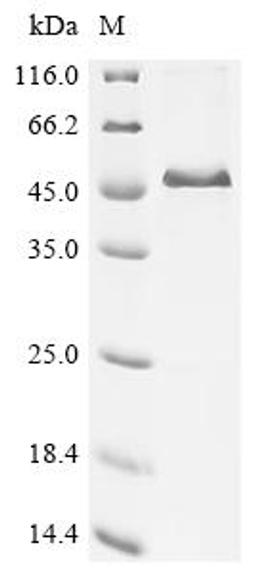 (Tris-Glycine gel) Discontinuous SDS-PAGE (reduced) with 5% enrichment gel and 15% separation gel.
