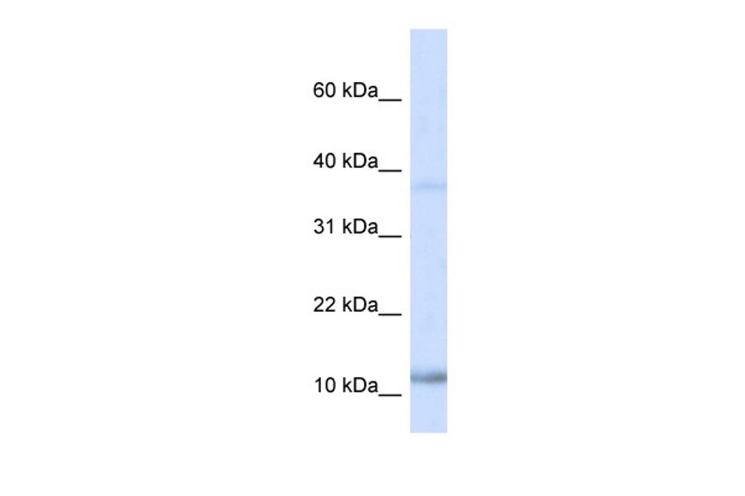 Antibody used in WB on Human Heart at 0.2-1 ug/ml.