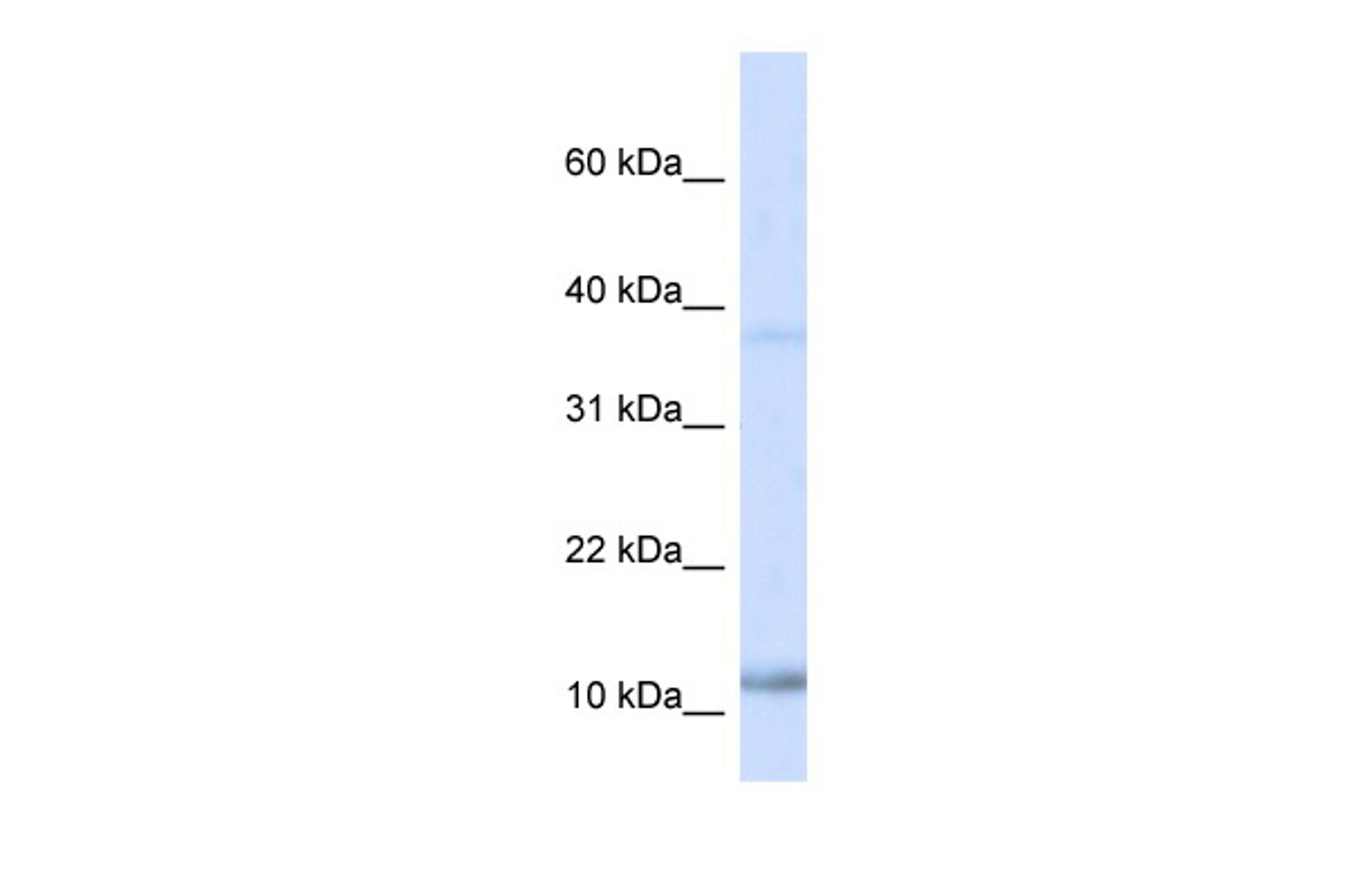 Antibody used in WB on Human Heart at 0.2-1 ug/ml.