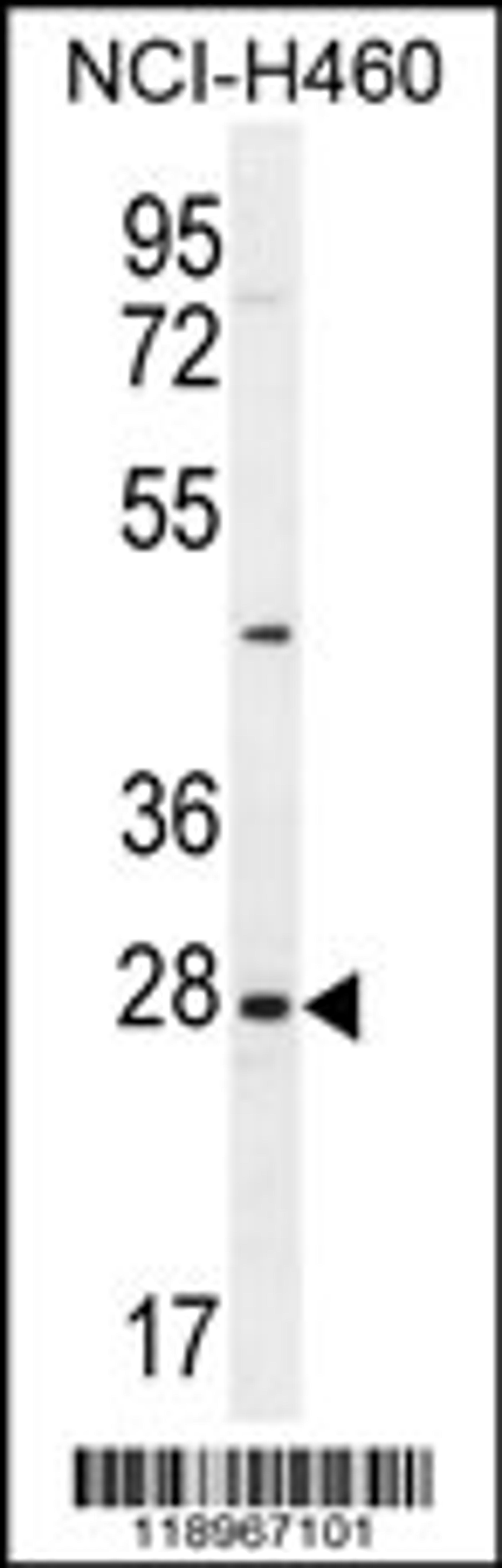 Western blot analysis in NCI-H460 cell line lysates (35ug/lane).