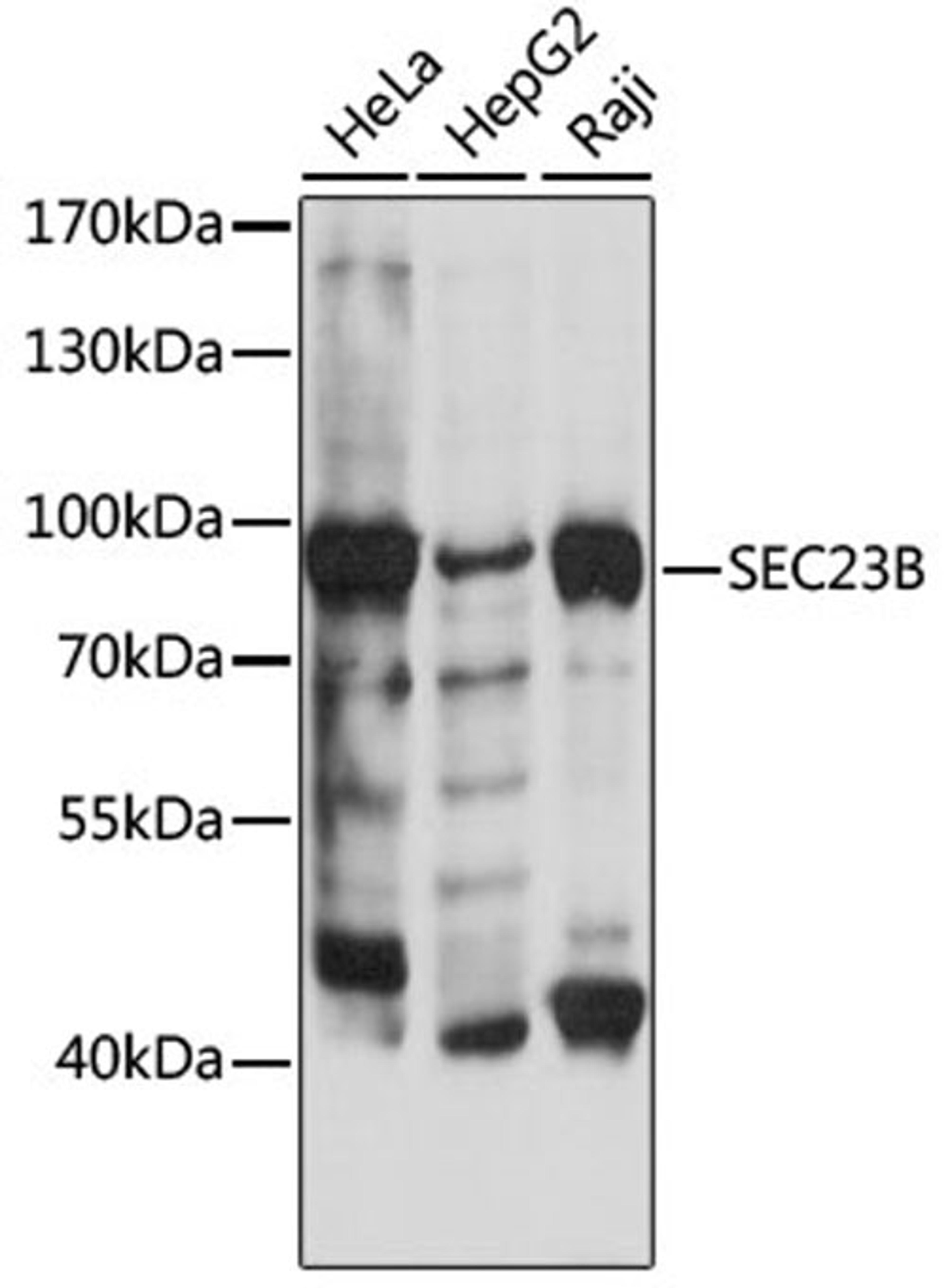 Western blot - SEC23B antibody (A15131)