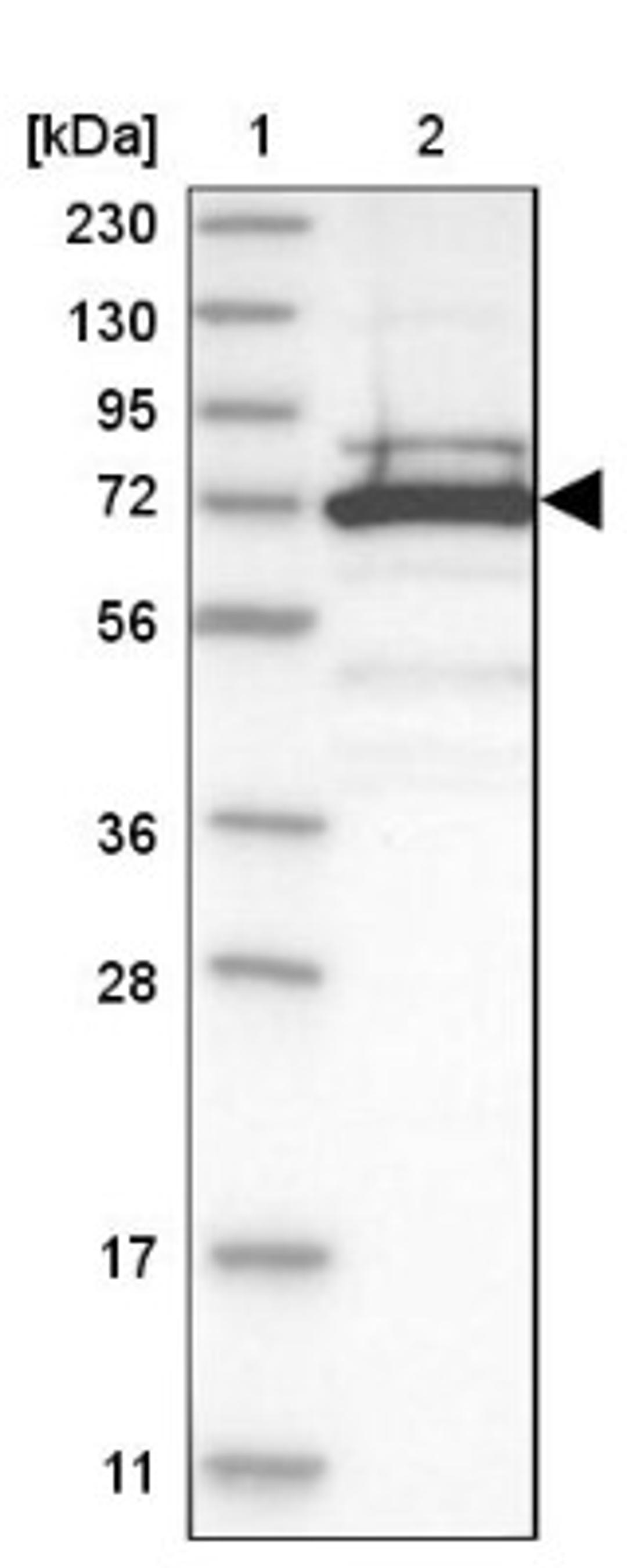 Western Blot: TRIM16 Antibody [NBP1-84921] - Lane 1: Marker [kDa] 230, 130, 95, 72, 56, 36, 28, 17, 11<br/>Lane 2: Human cell line RT-4