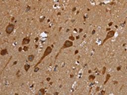 The image on the left is immunohistochemistry of paraffin-embedded Human brain tissue using CSB-PA289988(TRIM29 Antibody) at dilution 1/50, on the right is treated with fusion protein. (Original magnification: ×200)