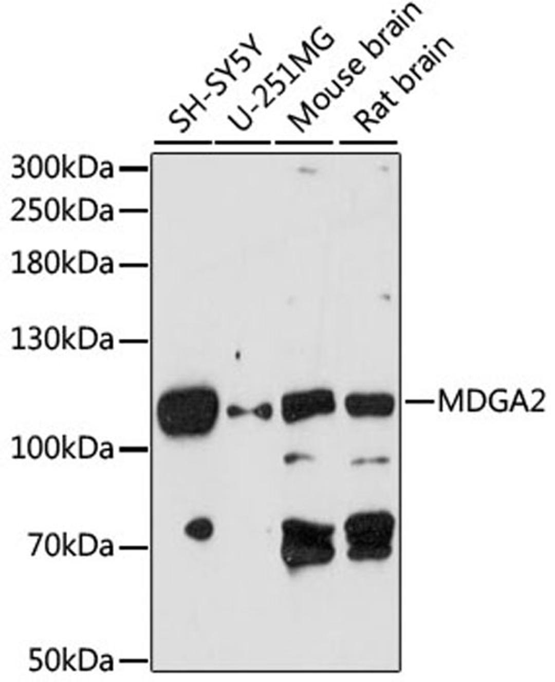 Western blot - MDGA2 antibody (A14969)