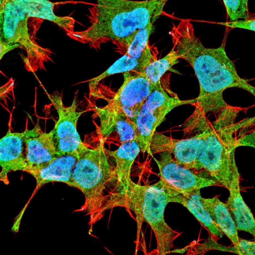 Immunofluorescence analysis of neuroblastoma cell line sk-n-be using ANK1 antibody