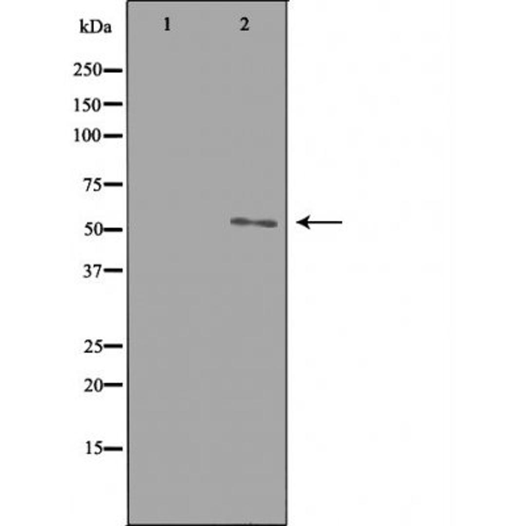 Western blot analysis of HepG2 cells using ETBR2 antibody