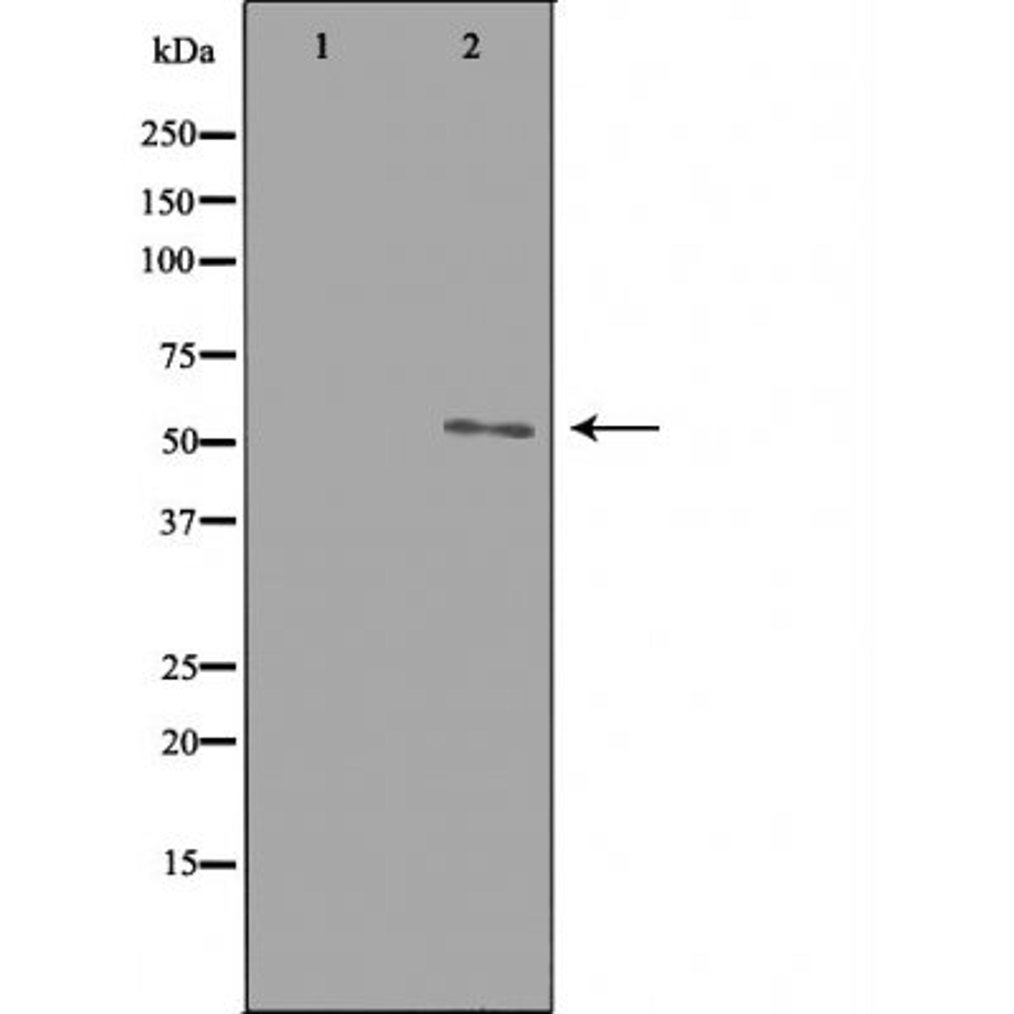 Western blot analysis of HepG2 cells using ETBR2 antibody