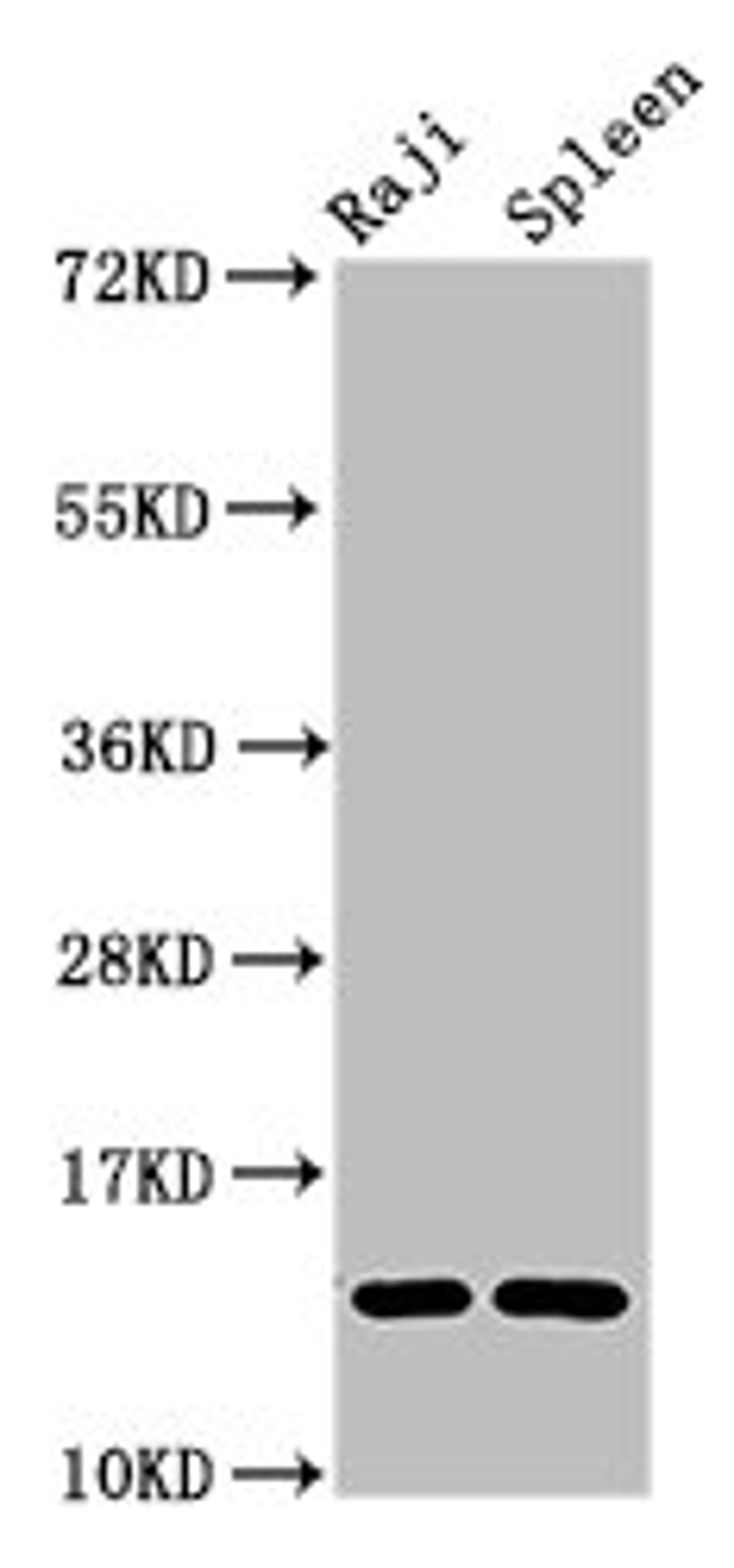 Western Blot. Positive WB detected in: Raji whole cell lysate, Rat spleen tissue. All lanes: GABARAPL2 antibody at 4µg/ml. Secondary. Goat polyclonal to rabbit IgG at 1/50000 dilution. Predicted band size: 14 kDa. Observed band size: 14 kDa