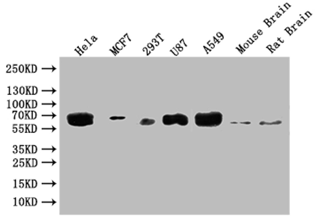 Western Blot. Positive WB detected in: Hela whole cell lysate, MCF-7 whole cell lysate, 293T whole cell lysate, U87 whole cell lysate. All lanes: GBA antibody at 1:2000. Secondary. Goat polyclonal to rabbit IgG at 1/50000 dilution. Predicted band size: 60, 58, 55, 51, 30 kDa. Observed band size: 60 kDa. 