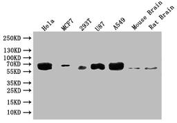Western Blot. Positive WB detected in: Hela whole cell lysate, MCF-7 whole cell lysate, 293T whole cell lysate, U87 whole cell lysate. All lanes: GBA antibody at 1:2000. Secondary. Goat polyclonal to rabbit IgG at 1/50000 dilution. Predicted band size: 60, 58, 55, 51, 30 kDa. Observed band size: 60 kDa. 