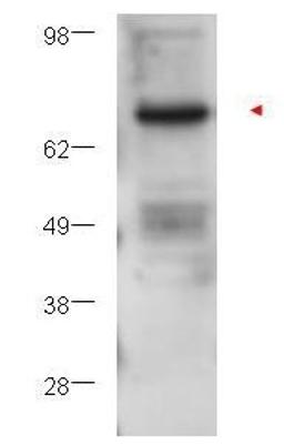 Western blot analysis of U251 whole cell lysate using Protein Kinase C Beta antibody