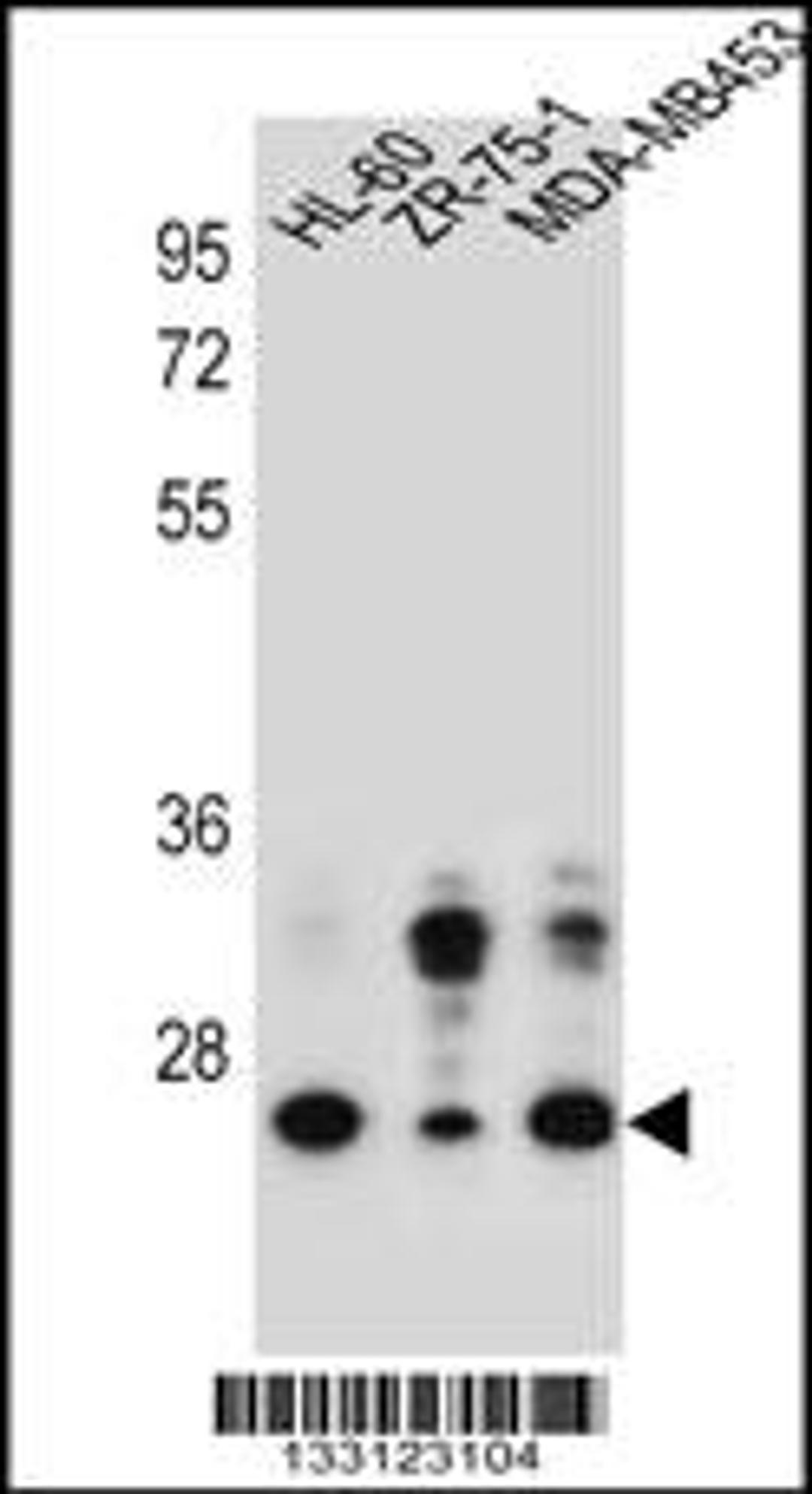 Western blot analysis in HL-60,ZR-75-1,MDA-MB453 cell line lysates (35ug/lane).