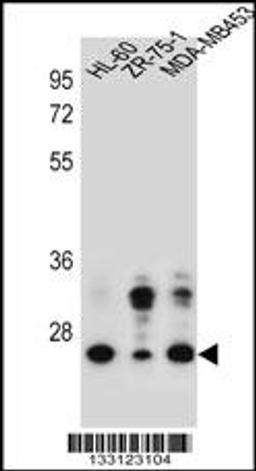 Western blot analysis in HL-60,ZR-75-1,MDA-MB453 cell line lysates (35ug/lane).