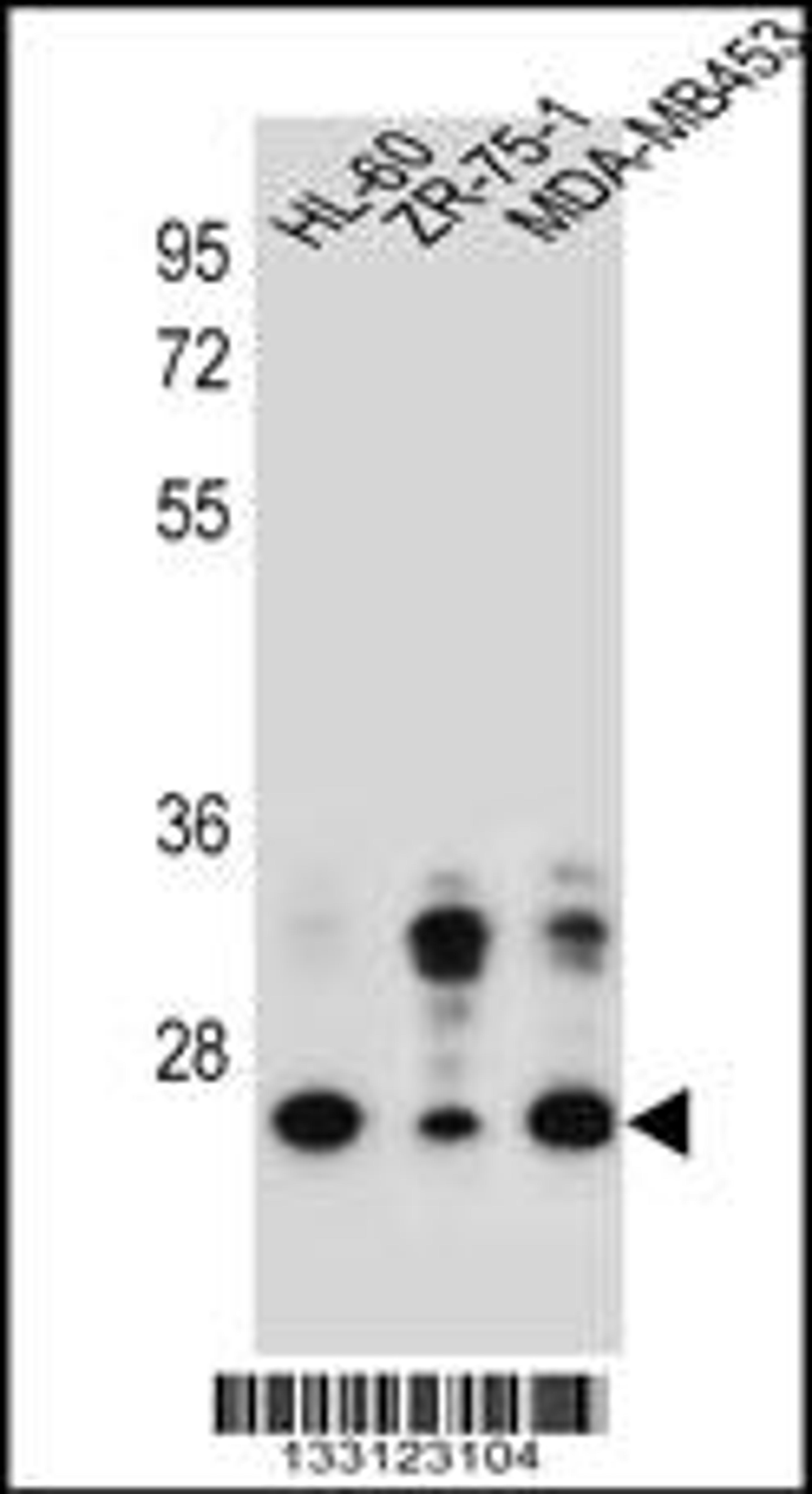 Western blot analysis in HL-60,ZR-75-1,MDA-MB453 cell line lysates (35ug/lane).