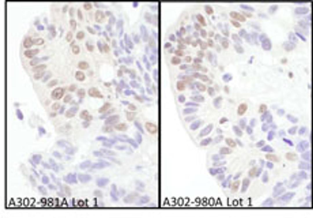 Detection of human eIF4AIII/EIF4A3 by immunohistochemistry.